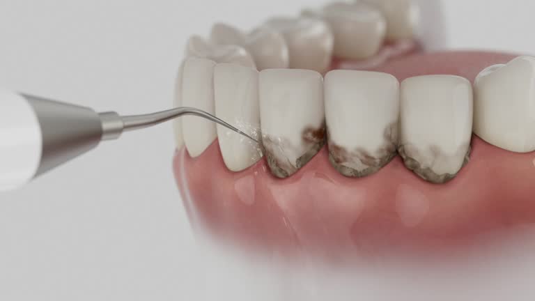 Reliable Invisalign Clear Aligners contractor in Jones Valley, CA by Smile Center Dentistry